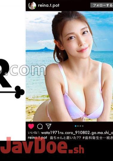 Mosaic 529STCV-219 A Perfect Beauty Who Has Intelligence, Tolerance, And Eroticism!